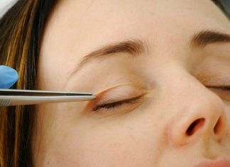 Хирургия глазного века: на стыке дисциплин Блефаропластика